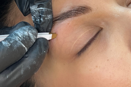 formation brow lift
