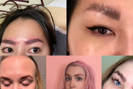 brow lift rate