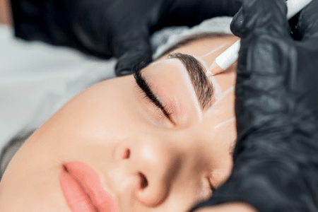 formation brow lift