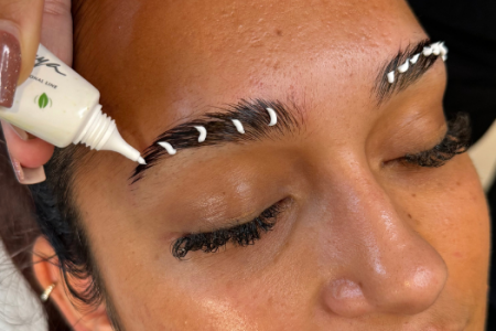 brow lift