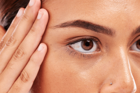 brow lift