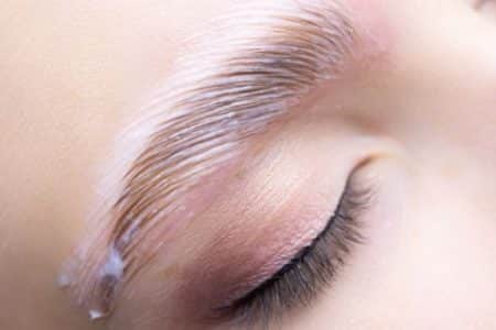 brow lift