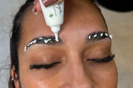 brow lift